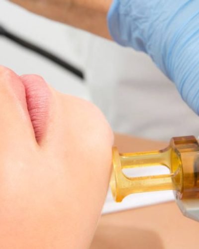 Demela-depilacion-laser-valencia-446A5694_retocada-1024x684-1-768x513